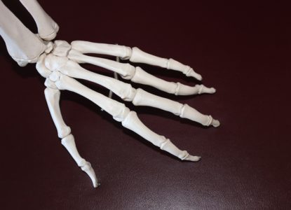 VDR Gene Osteoporosis Bone Health