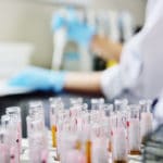 Is Whole Genome Sequencing Really Worth it?